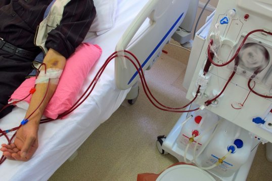 What is dialysis Treatment?